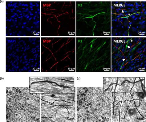 a Immunocytochemistry staining of myelin basic protein (MBP), P2 and ...