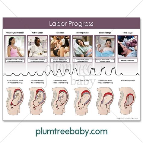 The Labor Progress Poster is a must-have for childbirth education. It summarizes the stages of ...