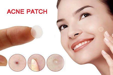 Acne Patch- manufacturer of wound dressing -chinmed