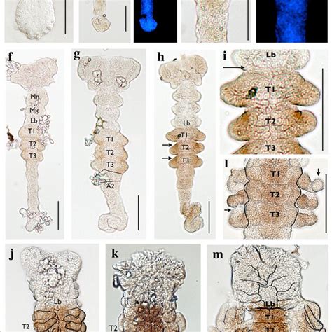 Horseradish peroxidase staining of H. limbata embryos using the Antp... | Download Scientific ...