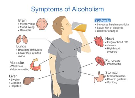 Alkolizm Hasta Belirtisi Stok Vektör Sanatı & Alkolizm‘nin Daha Fazla Görseli - Alkolizm, Grafik ...