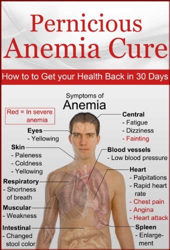 Pernicious Anemia Cure: How to Get Your Health Back in 30 Days (anemia ...