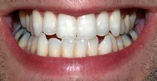 Teeth by David Shankbone | Shankblog - the home of David Sha… | Flickr
