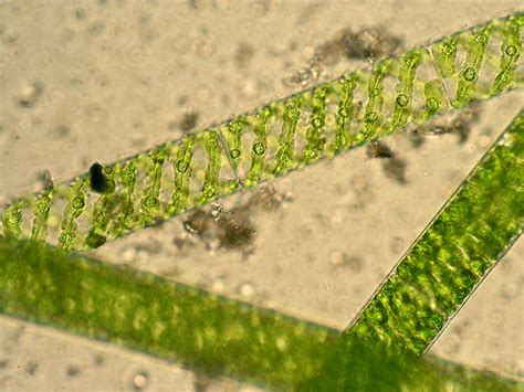 Spirogyra: Structure & Characteristics with Labeled Diagram