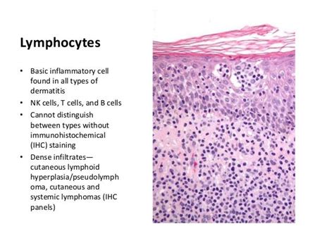 Interpretation of Pathology Reports in Biopsies for Dermatitis