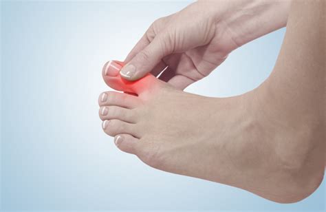 Big Toe Arthritis - The Frankel Foot & Ankle Center