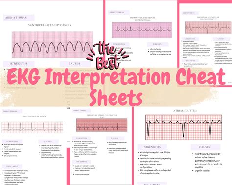 The Best EKG Interpretation & Heart Arrhythmias Cheat Sheet ,cheat ...