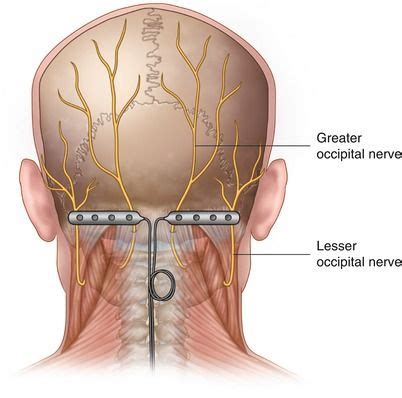 Greater Occipital Nerve