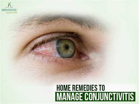 Ayurvedic home remedies for Conjunctivitis – Ayurvedic treatment kerala ...