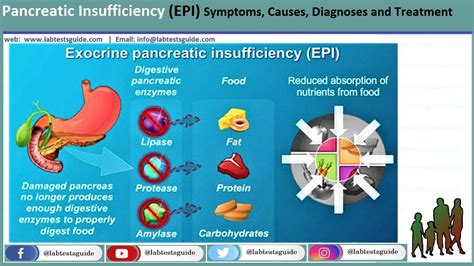 Pancreatic Insufficiency (EPI) | Lab Tests Guide