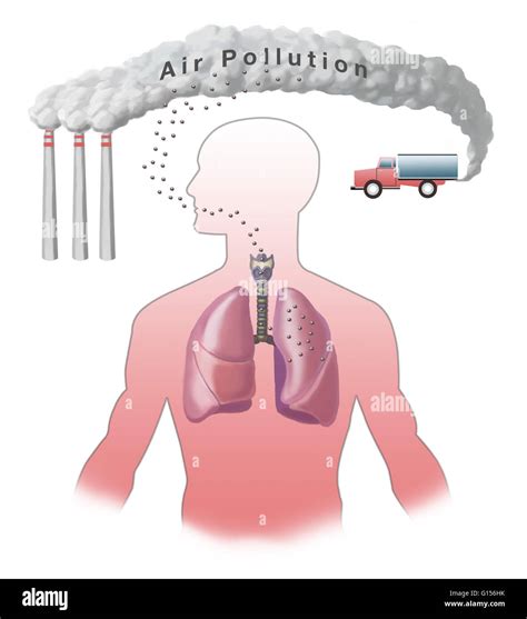 Illustration showing air pollution affecting a person's lungs. Air ...