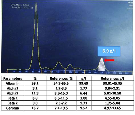 Serum protein electrophoresis showing the presence of a monoclonal peak... | Download Scientific ...