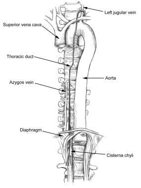 Chyle Fistula: Practice Essentials, Anatomy, Pathophysiology