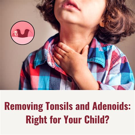 Removing Tonsils and Adenoids: Right for Your Child?