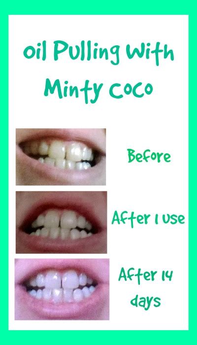 Oil Pulling With Minty Coco - My Random Musings