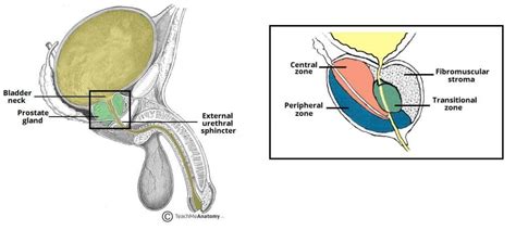 Prostate Cancer - Clinical Features - Screening - TeachMeSurgery