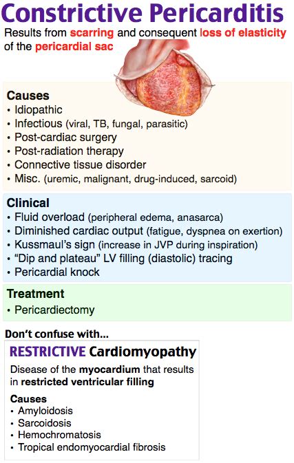 constrictive pericarditis,what to know?