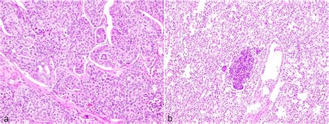 Morphological study of apocrine gland tumors in domestic Richardson’s ground squirrels ...