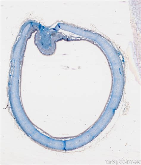 Trachea – Kit Ng, Ph.D.