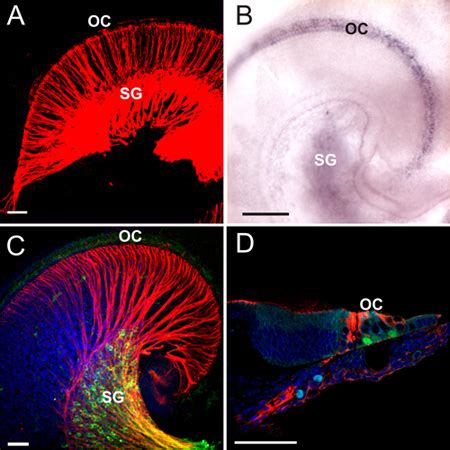 Combining Lipophilic dye, in situ Hybridization, Immunohistochemistry, and Histology | Protocol