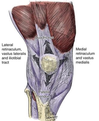 Fractures of the Patella | Musculoskeletal Key