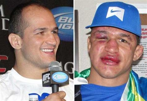 Totally Disfigured Faces of UFC Fighters (15 photos) | KLYKER.COM