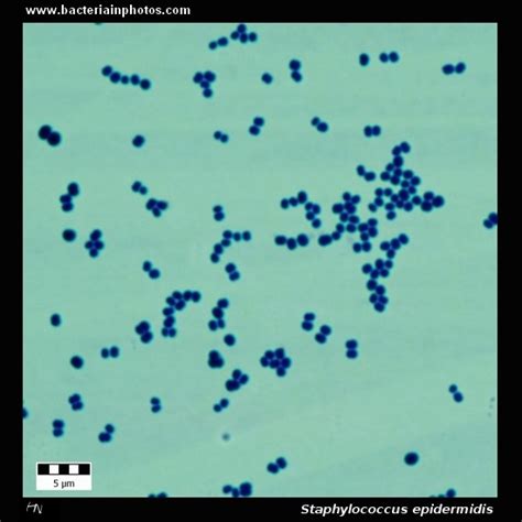 Staphylococcus epidermidis under microscope: microscopy of Gram ...