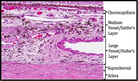 The retinal choroid as an oculovascular biomarker for Alzheimer's dementia: A histopathological ...