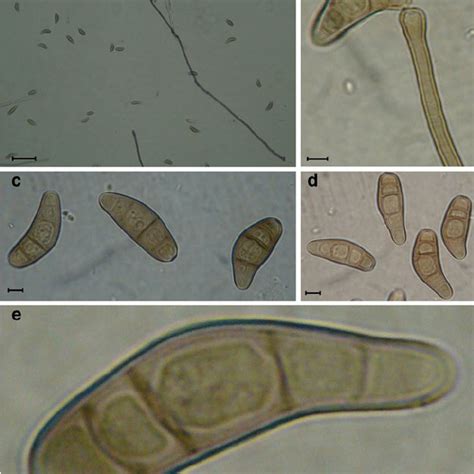 Symptoms of leaf spot caused by Bipolaris coicis on adlay. a leaf spot... | Download Scientific ...