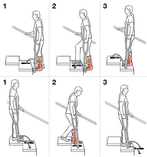 Text - Step-by-Step: Using Crutches on Stairs - HealthClips Online