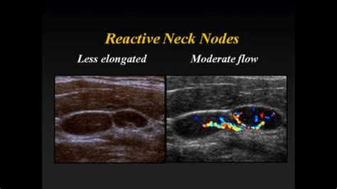 Cervix Ultrasound Labeled