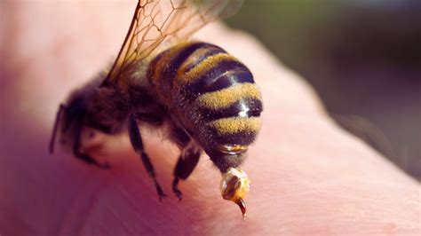 Bee Sting Treatment: Symptoms and Causes Exposed!