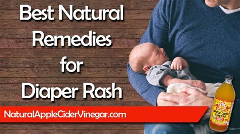 5 Natural Diaper Rash Home Remedies that Actually Work - YouTube