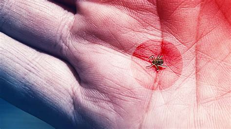 Tick Bite Symptoms to Know, According to Experts