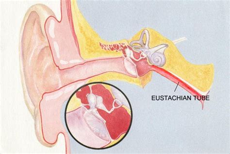 Understanding the Reasons Behind Blocked Eustachian Tube | by Adrian Jacob | Medium