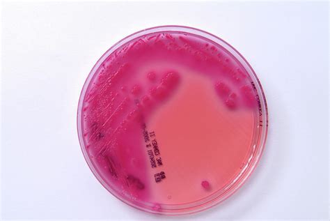 E. Coli Bacterial Culture Photograph by Cc Studio/science Photo Library - Fine Art America