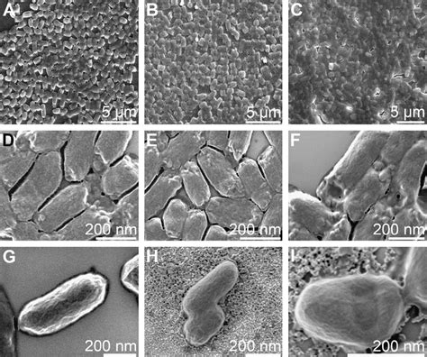 Scanning electron microscopic analysis of E. coli. Bacteria without ...