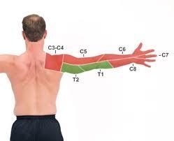 Cervical Dermatome Map Human Body Anatomy, Muscle Anatomy, Hand Therapy ...