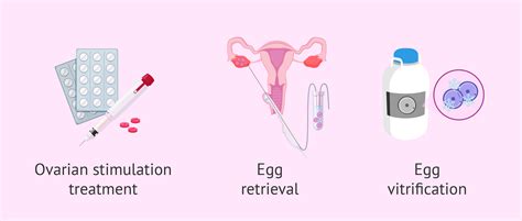 Oocyte vitrification process