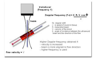 Doppler Physics: DOPPLER ULTRASOUND : PRINCIPLES & PRACTICE