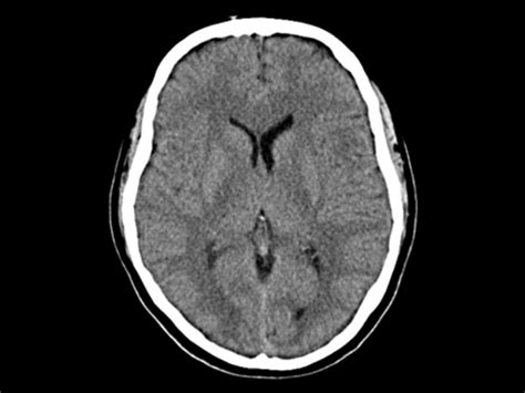 ct-head - Charter Radiology