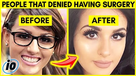 Sssniperwolf Before And After – Telegraph