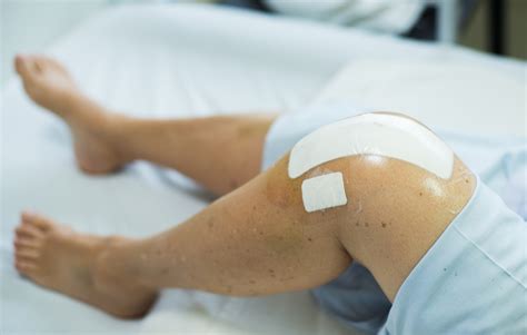 Knee Surgery: How Do You Know If You Need a Knee Replacement ...