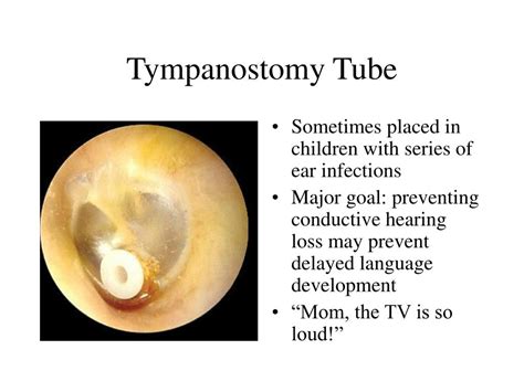 PPT - Physical Diagnosis Scalp, Ears,Nose, Sinuses PowerPoint Presentation - ID:6764242