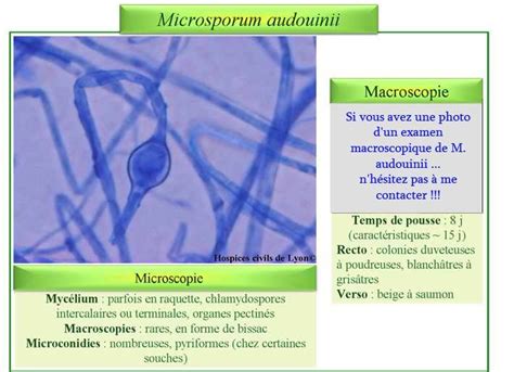 Microsporum audouinii | Macroscopique, Biologie, Science