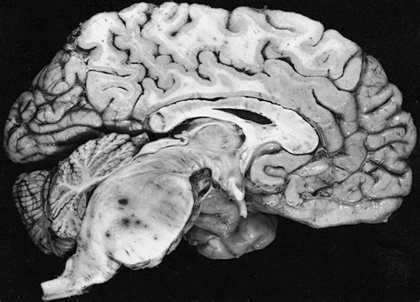 The Pons Function | The Human Memory