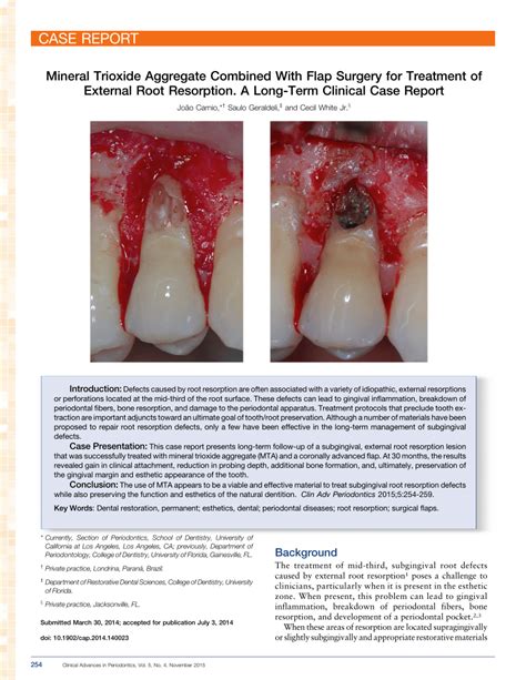 (PDF) Mineral Trioxide Aggregate Combined With Flap Surgery for Treatment of External Root ...