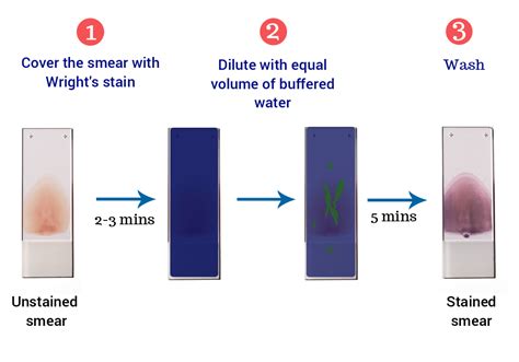 Wright's Stain : Preparation, Principle, Procedure and Results