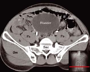 ureter bladder anatomy