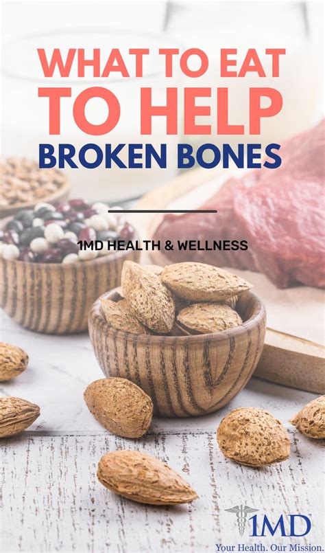 What to Eat to Help Broken Bones | Heal broken bones, Bone healing foods, Broken bone